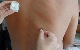 Cách hay trị cảm lạnh