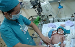 'Khó tách bé sơ sinh 2 đầu'
