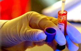 Một số trường hợp bắt buộc xét nghiệm HIV