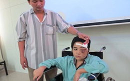 Cắt bỏ khối u to bằng cái cốc