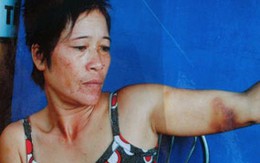 Uất ức vì bị lột quần áo, làm nhục giữa ban ngày 