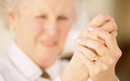 Lưu ý cho người viêm khớp khi trời chuyển lạnh