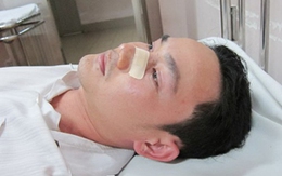 CSGT đập người đi đường gãy mũi