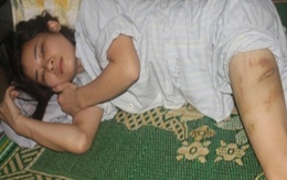 Ký ức kinh hoàng người vợ bị chồng đánh, bắt xem clip ân ái với "bồ nhí" 