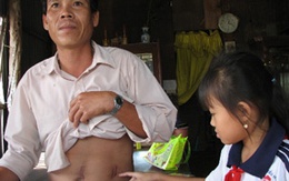 Ông lão thù dai, hại hàng xóm