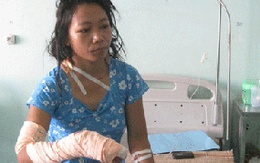 Chồng chém vợ cụt 2 ngón tay, đứt bánh chè