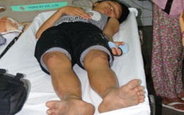 Một bé gái 14 tuổi bị bảo vệ đạp, đánh phải nhập viện? 