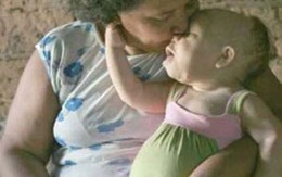 Cô gái 30 như bé 9 tháng tuổi 