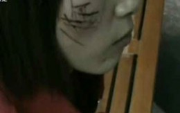Tự rạch nát mặt để giữ trinh tiết 