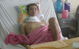 Cứu sống bệnh nhân giập hơn 90% khí quản