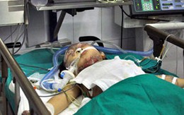 Bé gái vụ nổ xe máy được ra phòng điều trị