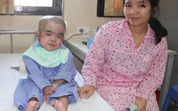 Gặp lại em bé bị "lột da ếch"