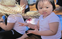 Để bé không bị nổi mẩn đỏ da sau sinh