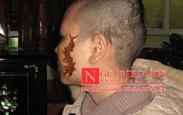 Cô gái bị cạo trọc, xăm quái vật vào mặt và ngực
