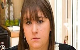 Kỳ lạ cô gái có thể chết vì... quả chuối