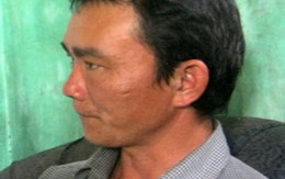 Một phụ nữ bị chồng bạo hành 10 năm