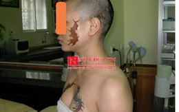 Vụ cô gái bị cạo đầu, xăm quái vật vào mặt: Triệu tập vợ chồng chủ quán