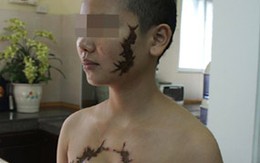 Cô gái bị xăm hình quái vật lên mặt từng định tự tử