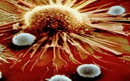 Mức nhiễm HIV ở Việt Nam còn thấp dưới 1% nam giới và phụ nữ Hải Phòng nhiễm HIV