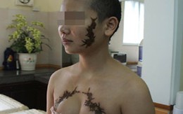 Cô gái bị xăm được chữa miễn phí 