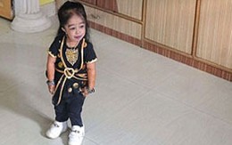 Ảnh thiếu nữ 18 tuổi chỉ cao... 60cm