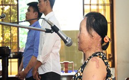 Xót lòng người phụ nữ bị axit hủy hoại