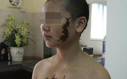 'Cô ấy khóc khi bị xăm hình con rết lên mặt'