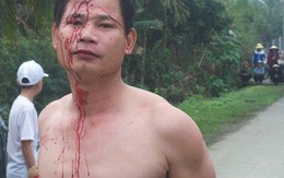 Dân nói bị đánh, công an bảo không
