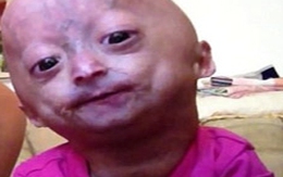 Sốc với cô bé có gương mặt như "người ngoài hành tinh"