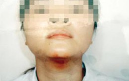 Nỗi lòng cô giáo bị bạo hành