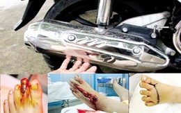 "Hậu" những vụ tai nạn kinh hoàng do nắp pô xe máy: Sự thờ ơ đến kinh ngạc