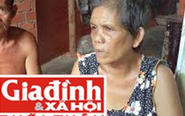 Rớt nước mắt chấp nhận sống dị tật vì không xoay nổi 24 triệu đồng “nuôi” vỏ não