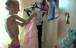 Phát hoảng thiếu nữ 20 tuổi nặng... 20kg