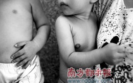 Bé 1 tuổi ngực lớn như thiếu nữ 
