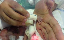 Bé sơ sinh hơn 3 lạng sống sót diệu kỳ