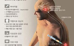 Hiếp dâm trẻ em sẽ bị... triệt sản?