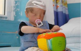 Cậu bé chào đời không có... mắt