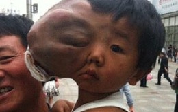 Cậu bé “hai đầu” xin tiền trên phố