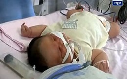 Bé sơ sinh "khổng lồ" nặng... 7,1 kg