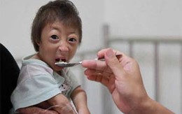 Lạ lùng bé gái không bao giờ lớn 