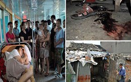 Bị trộm... ‘của quý’ khi đang ngủ