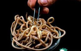 300 con giun làm tổ trong bụng cô gái