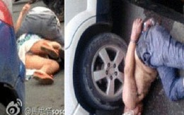 Một cô gái bị tài xế gặm nát mặt