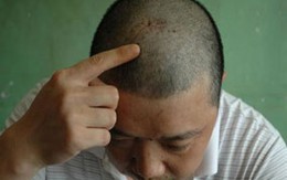Đánh toác đầu bác sĩ vì... dám từ chối phong bì
