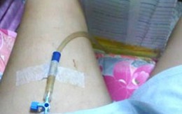 Kinh khủng tiêm nước tiểu để giảm được 20 kg 