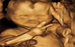 Thai nhi nằm trong bụng mẹ đã biết ra ký hiệu