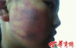 Cô giáo xui 50 học sinh tát bạn cùng lớp