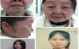 Gái trẻ biến thành bà già 70 sau khi sinh