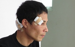 Thanh Oai - Hà Nội: Suýt chết vì bị chú và em họ truy sát