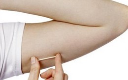 Que cấy tranh thai: có thực sự an toàn với phụ nữ đang cho con bú? 